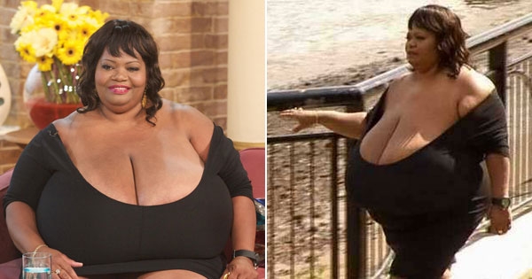 57岁「全世界最大天然巨乳」女子熬过霸凌岁月后，她靠着胸部完成的事让大家都超诧异！